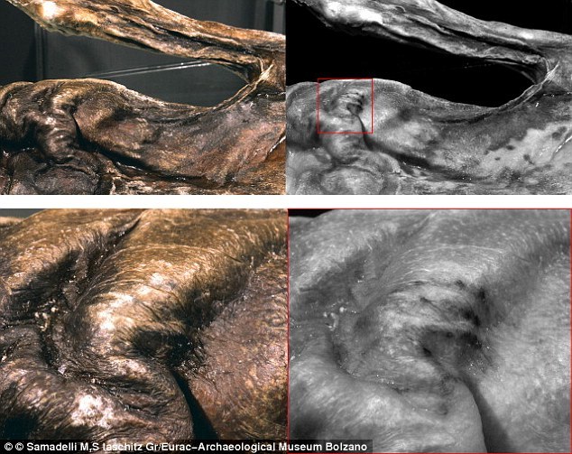 5300年前冰人奥茨发现新纹身平行线条似针刺