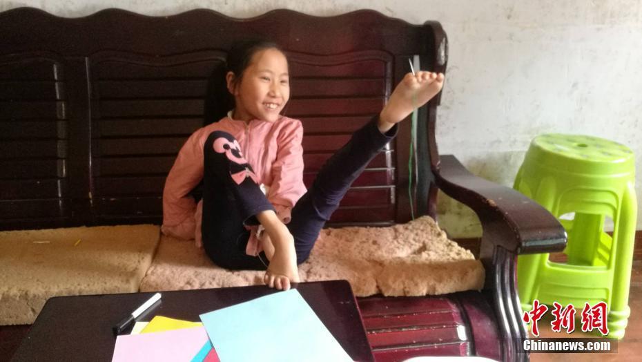 四川9岁患疾小女孩笑对人生脚怀绝技上演励志故事