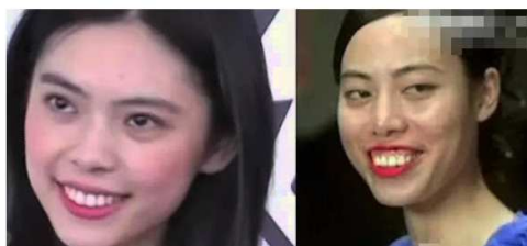 周星驰电影的第一丑女,不是莫文蔚,也不是赵薇,是龅牙