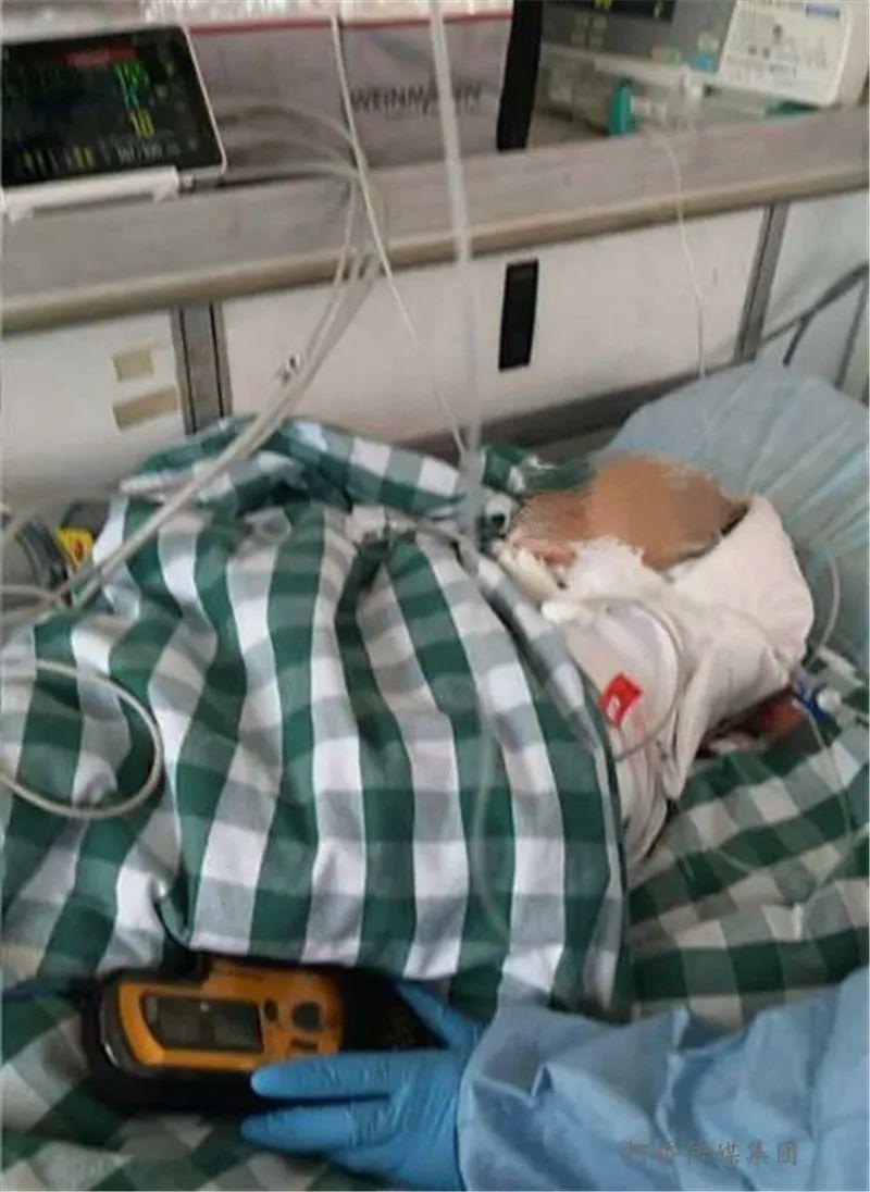 14个月宝宝被高空坠物砸成脑死亡！肇事者被找出，原因令人愤怒