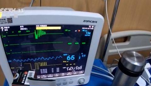 零点几秒插管 深静脉盲穿刺 他们扼住了ICU的生死时速