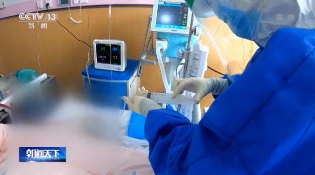 零点几秒插管 深静脉盲穿刺 他们扼住了ICU的生死时速