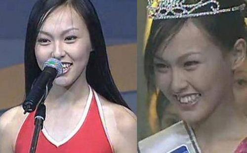 唐嫣十八岁选秀画面曝光 穿性感泳装大长腿吸睛