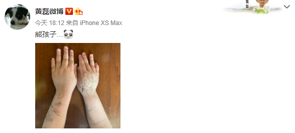 黄磊罕见分享3岁儿子近况 弟弟手臂画满涂鸦