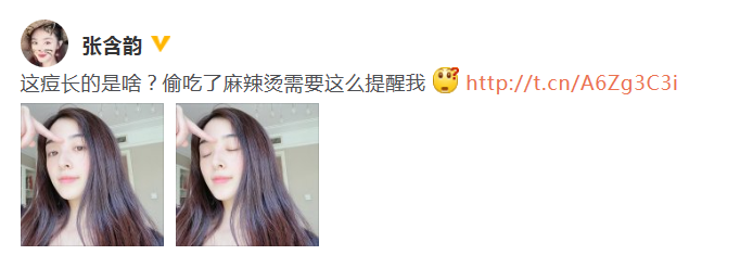 张含韵绿洲晒近照鼻梁冒痘 自曝偷吃麻辣烫超搞怪