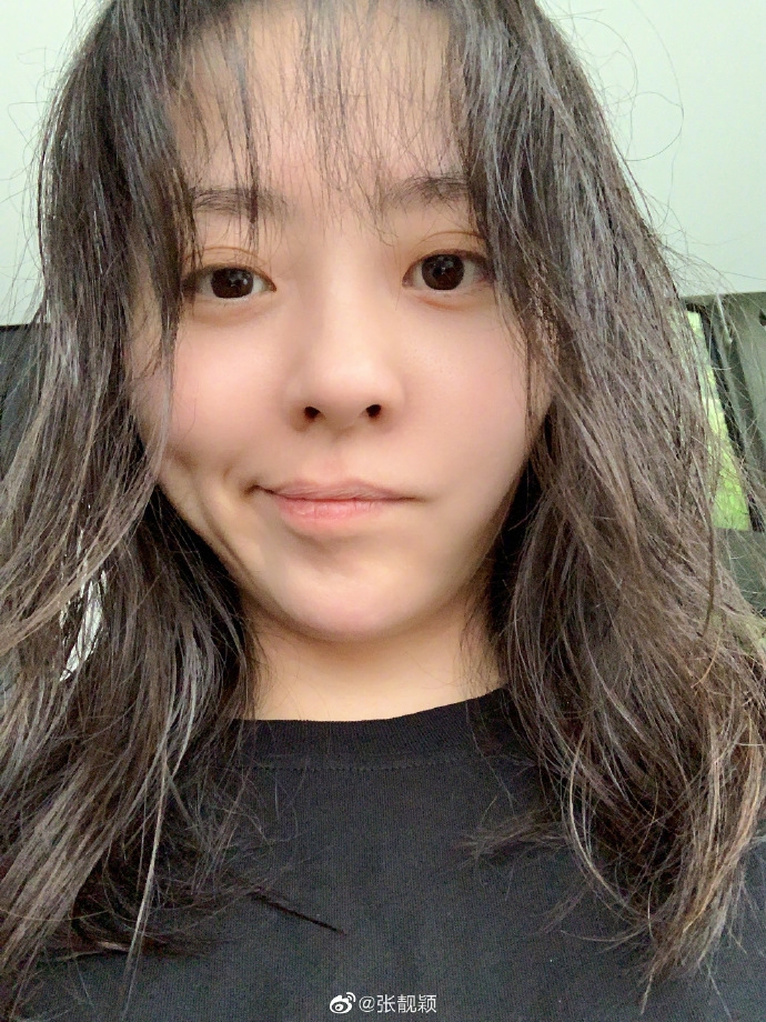 张靓颖咬到自己撒娇求安慰 晒素颜照自侃红颜薄皮超逗趣