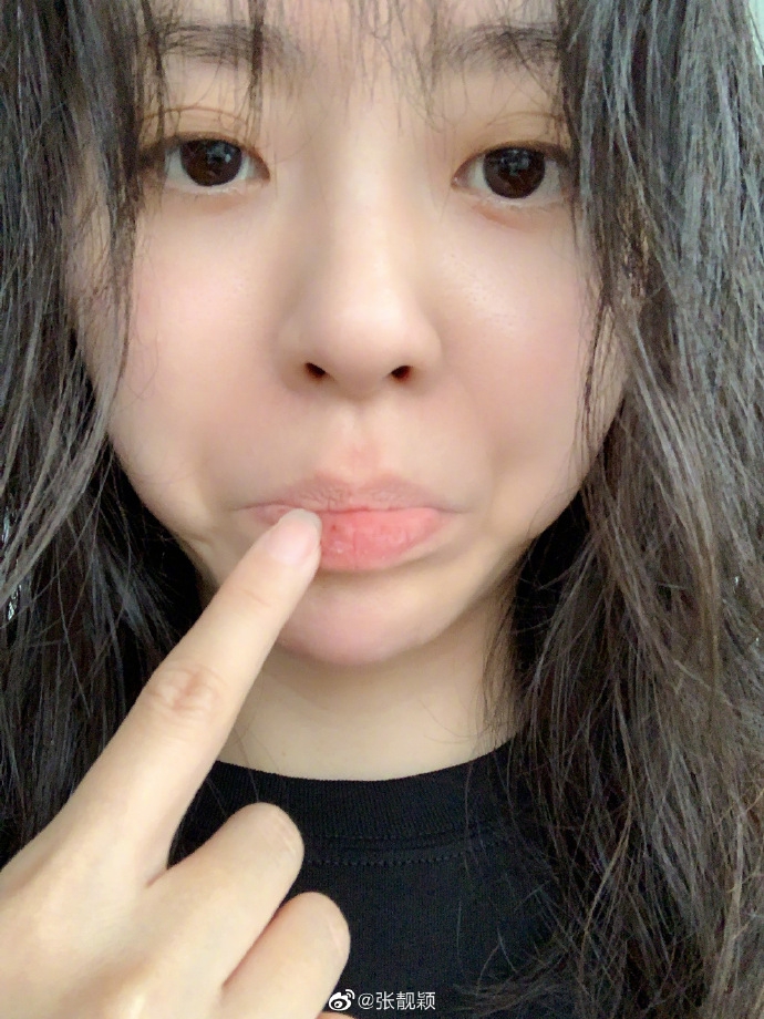 张靓颖咬到自己撒娇求安慰 晒素颜照自侃红颜薄皮超逗趣