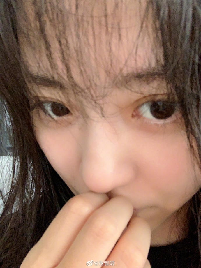 张靓颖咬到自己撒娇求安慰 晒素颜照自侃红颜薄皮超逗趣