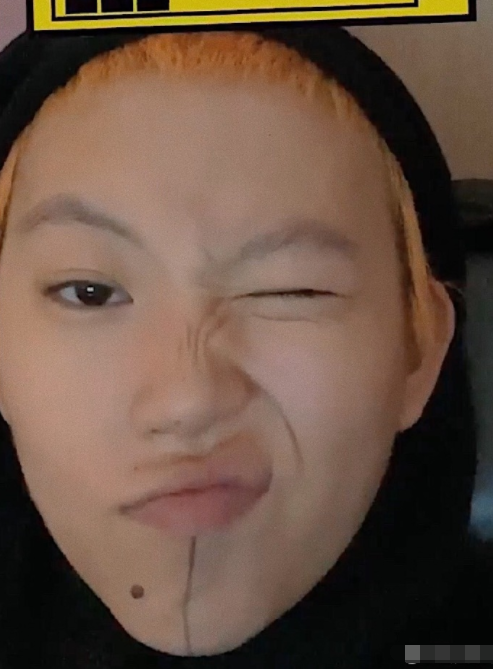 窦靖童宅家逗猫可爱俏皮 罕见穿吊带出镜肩膀胎记醒目