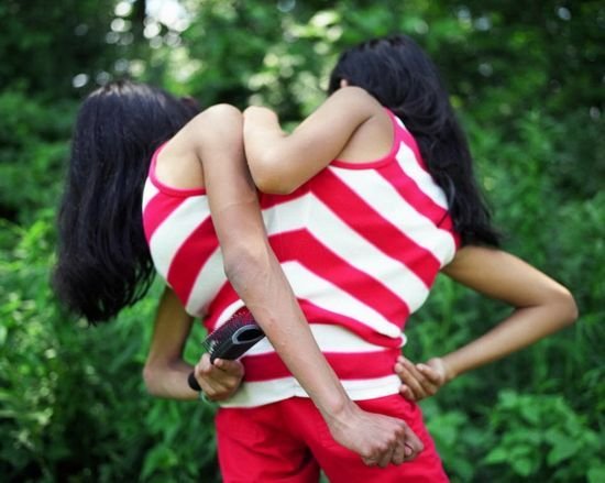 连体姐妹共用身体