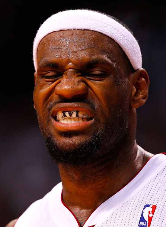 詹姆斯的牙齿真不好看.