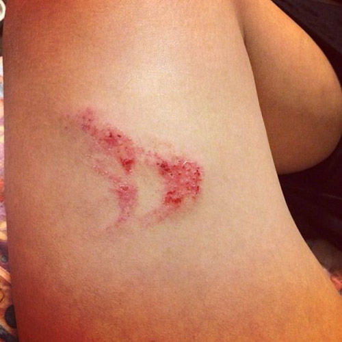 王大雷赛后晒受伤照片大腿两道血印感叹值了