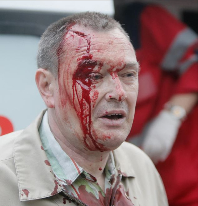 乌克兰顿涅茨克市中心发生暴力冲突 市长遭枪击