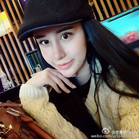 15岁少女为情整容变蛇妖一夜爆红私照曝光