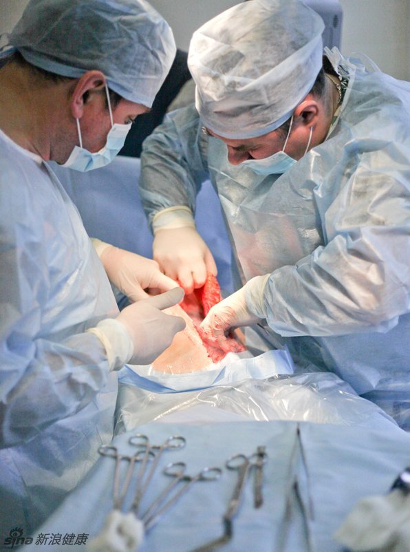 剖腹产分娩手术全过程