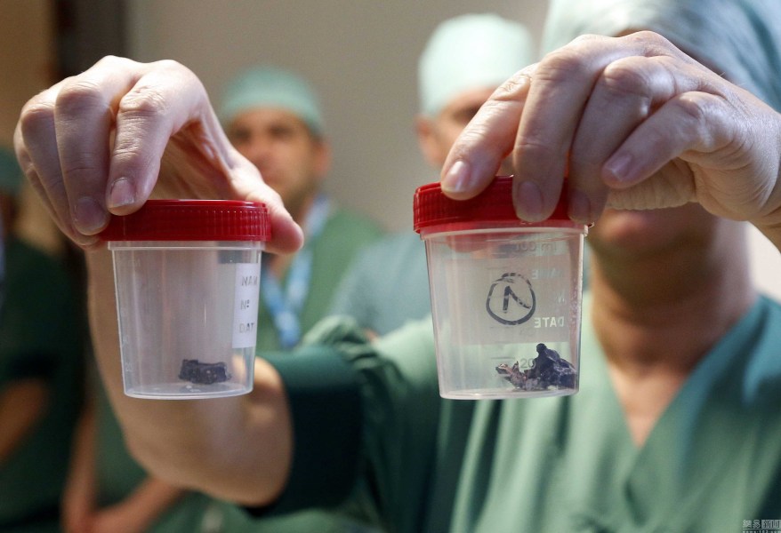 比利时医护人员展示恐袭伤者体内弹片