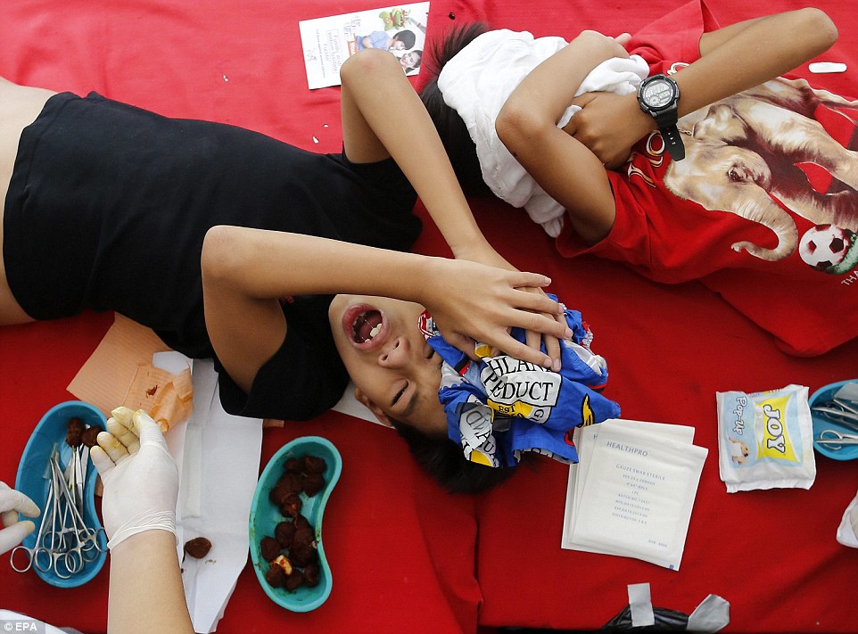 课桌变手术台菲律宾300男童教室中行割礼手术