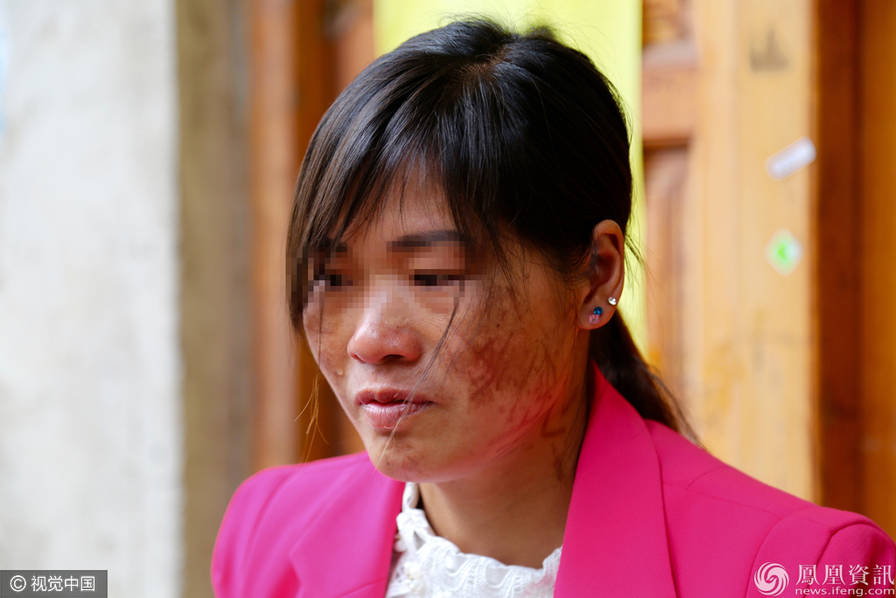 女子被老公和小三"划百刀" 几近毁容