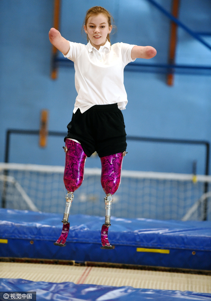 英国无四肢女孩表现完美赢得全英蹦床冠军