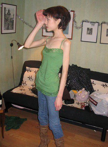 瘦成这样真的会吓到人的!