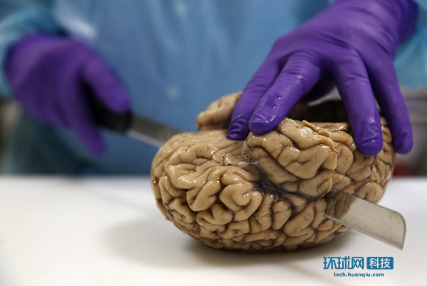 英国大学研究脑神经疾病 对人脑进行组织切片