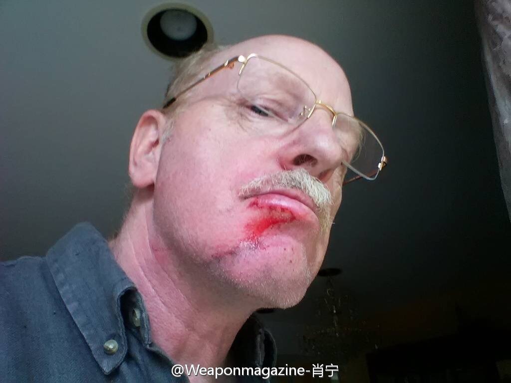 枪迷玩97式步枪炸膛下巴受伤