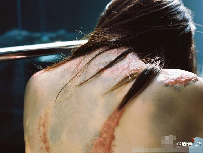 11 她曾被官二代同学泼汽油点火 如今拍写真露伤疤