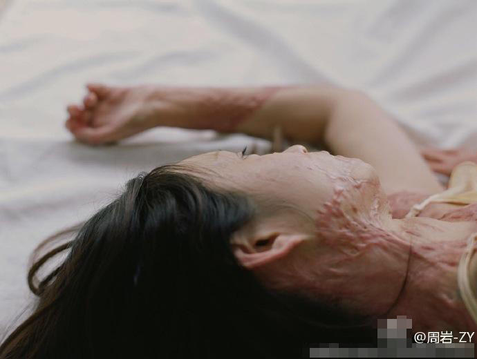 11 她曾被官二代同学泼汽油点火 如今拍写真露伤疤