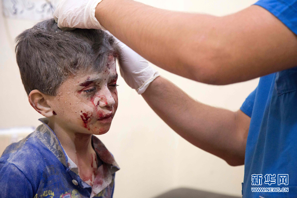 叙阿勒颇再遭空袭致25人死 儿童受伤场面令人揪心(组图)