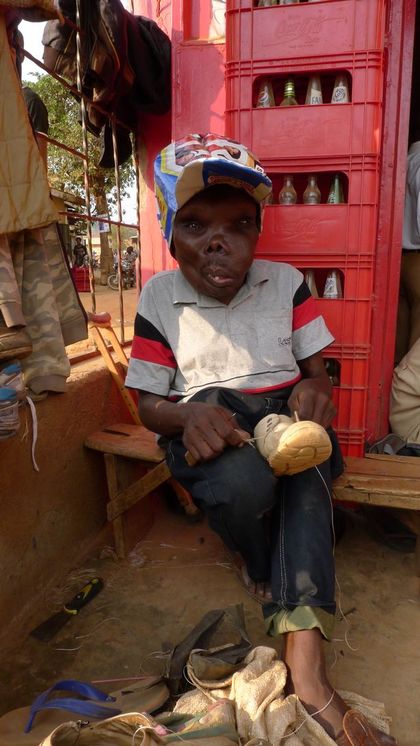 9 非洲一男子患病脸变形 不畏嘲笑成当红歌手