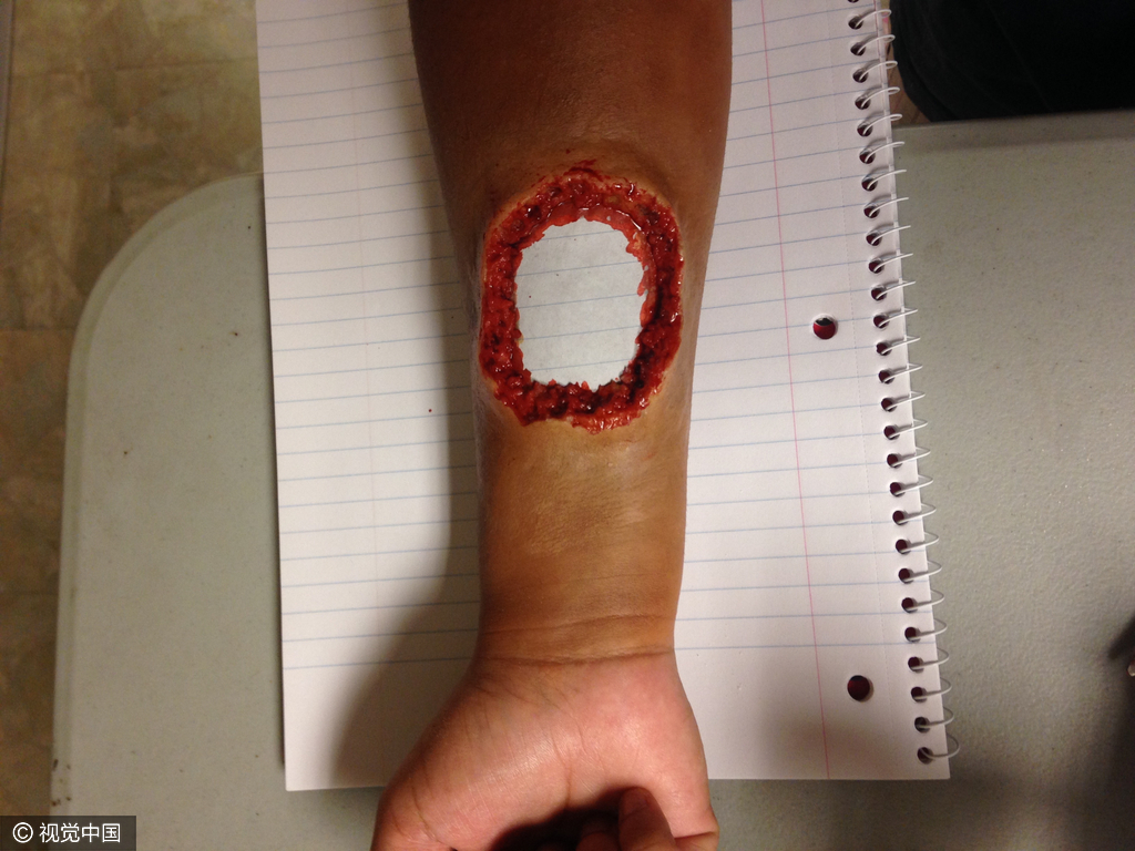 血腥慎点!美17岁化妆师超逼真受伤妆容