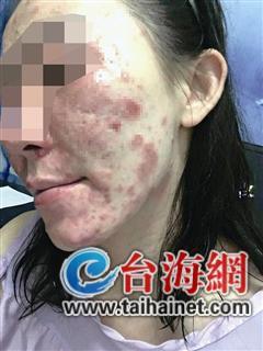 美妆蛋为什么要打湿用 使用美妆蛋的技巧华体会体育官方网站（HTH Sports）