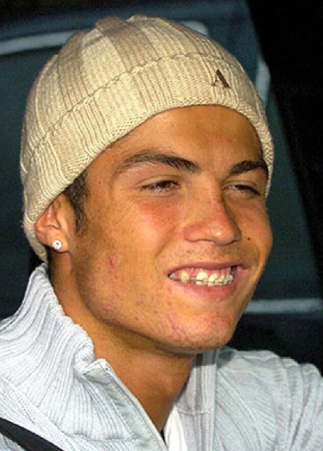 c罗"整形"记:乡巴佬到高富帅 脸上全是假的?