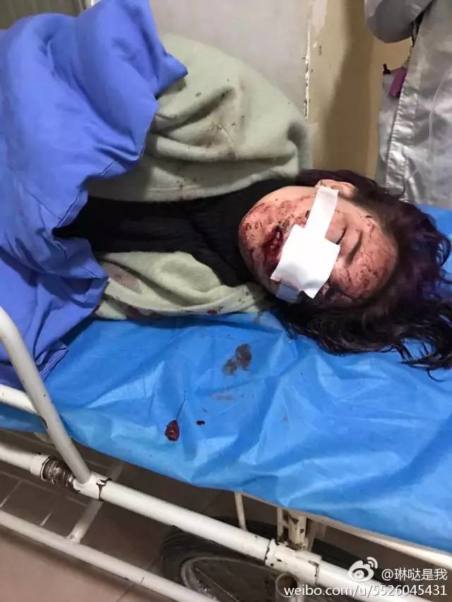 只因说东北话女子丽江被暴打毁容如果2月11日之后我消失了那我一定被