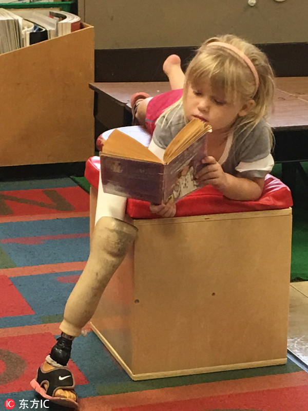 美截肢小女孩乐对人生戴假肢征服体操场