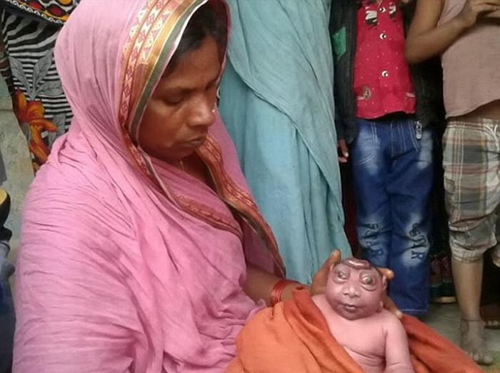 4 印度女子产下无脑巨眼怪婴 当地人奉若神明