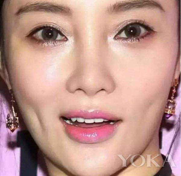 李小璐放弃大双眼皮美回来了!杨幂怎么越变越宽?