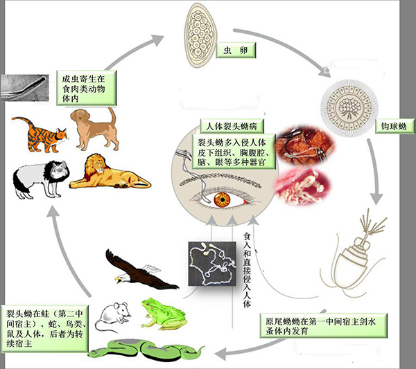 图说:曼氏裂头蚴病是我国重要的食源性寄生虫病之一.华山医院供图