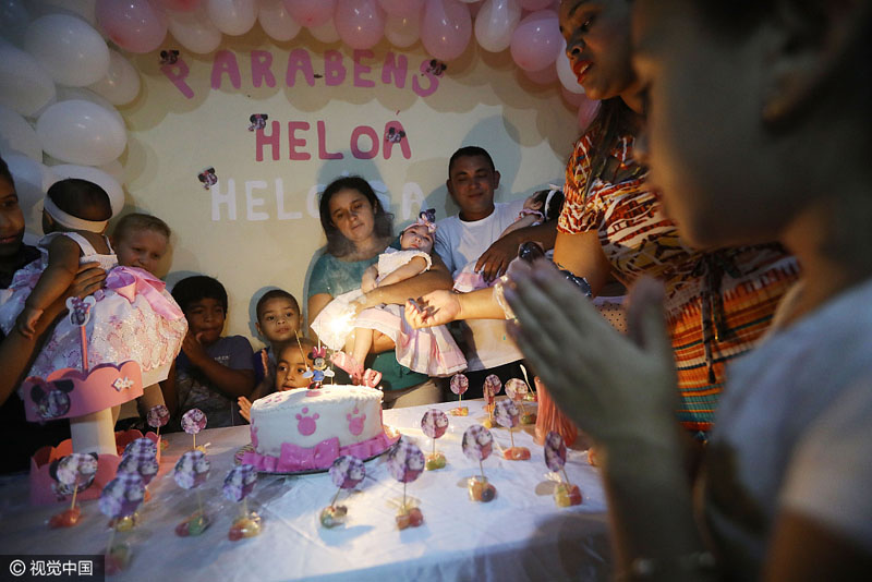 4 巴西小脑症畸形双胞胎庆一周岁生日