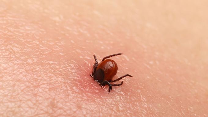 正确处理各种叮咬蛰伤别让意外破坏假期好心情