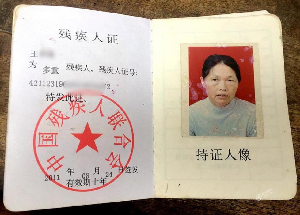 面具女子的丈夫肖宏法今年56岁,左腿有残疾
