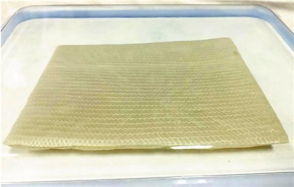 烧伤病人或无需植皮国产人工真皮进入临床试验