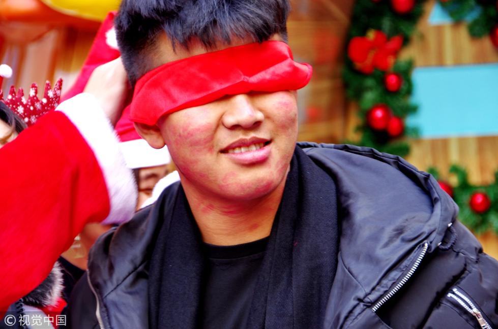 武汉上演花式kiss秀 满脸口红唇印引围观