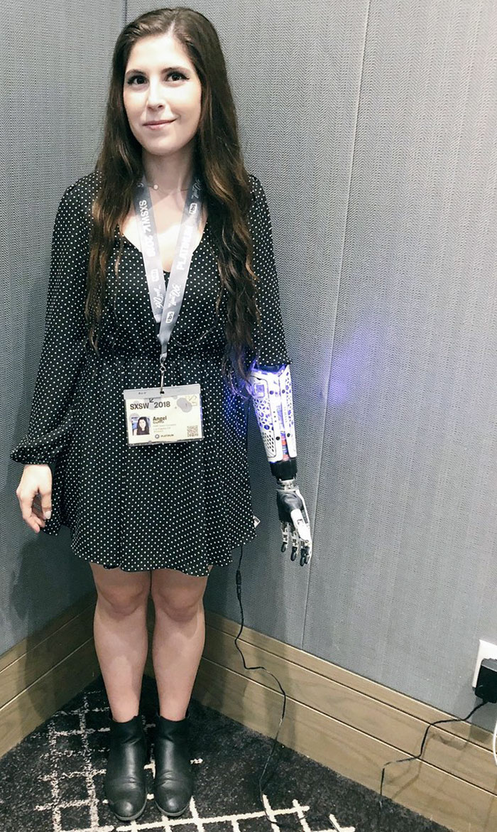 6 假肢没电了!美国独臂女孩求充电却遭拒绝