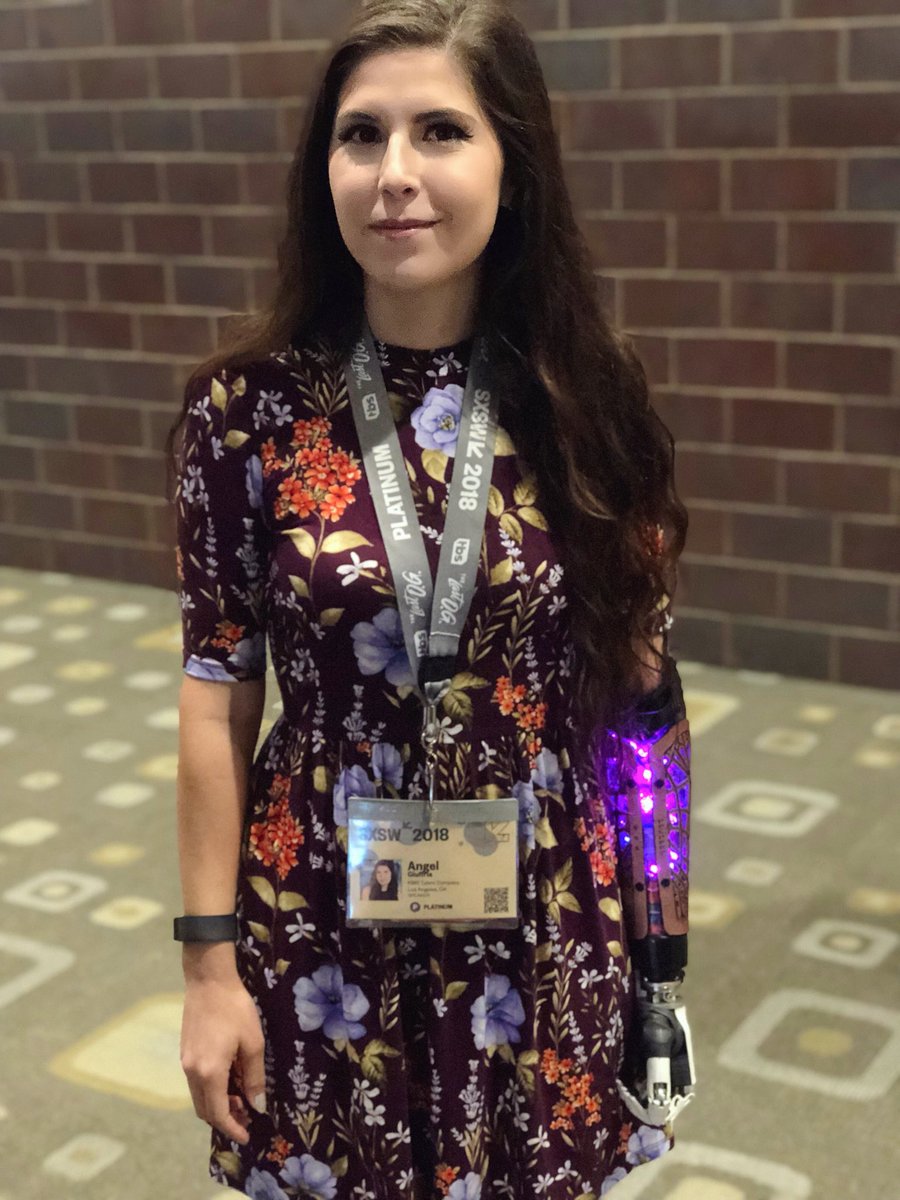 6 假肢没电了!美国独臂女孩求充电却遭拒绝