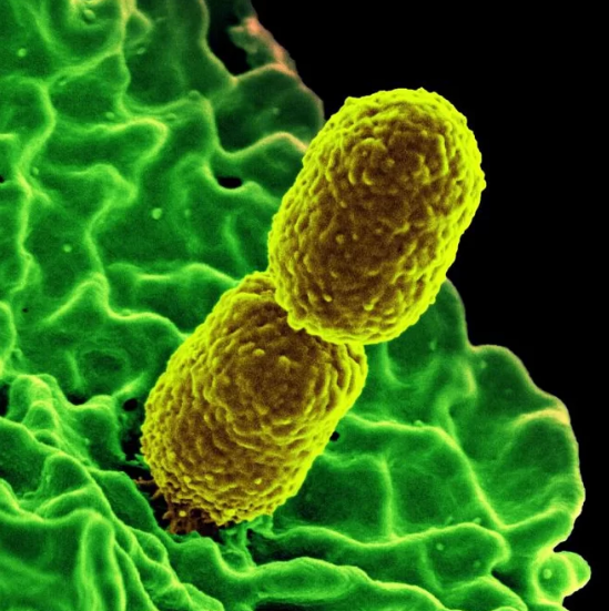 "噩梦细菌",学名为"耐碳青霉烯类抗菌药物的肠杆菌科细菌"(cre),属于"