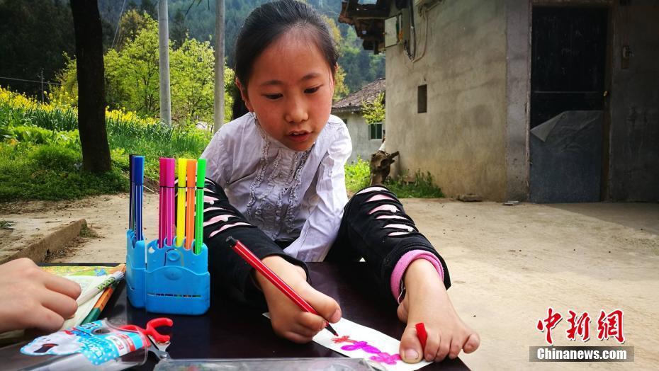 四川9岁患疾小女孩笑对人生 脚怀绝技上演励志故事