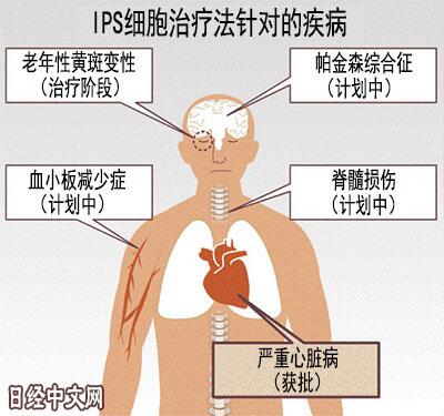 即将进入疑难重病领域日本走近ips再生医疗