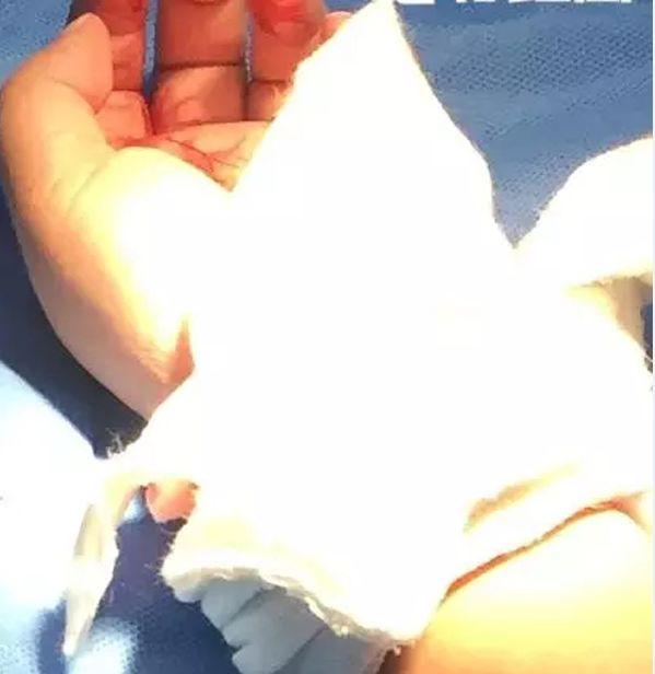 童先生的儿子手部被狗咬伤。 江苏电视台“南京零距离” 图