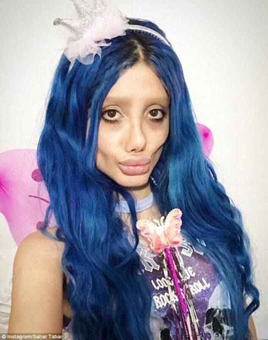 整容50次变僵尸版安吉丽娜-朱莉?少女否认(图)